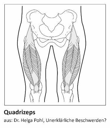 Zeichnung: Quadrizeps-Muskeln vorne am Oberschenkel