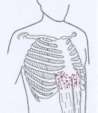 Brustkorbschmerz gerader Bauchmuskel - Behandlung durch Pohltherapie