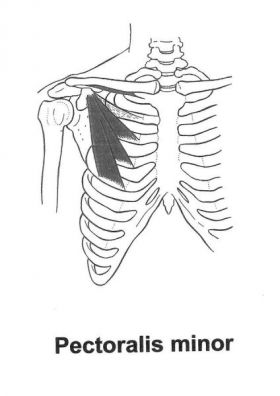Kleiner Brustmuskel (Pectoralis minor) - Behandlung durch Pohltherapie