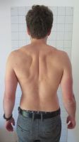 Mann mit nach hinten gezogenen Schultern - Behandlung durch Pohltherapie 