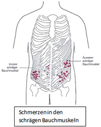 Rechten stechen oberbauch im Schmerzen im