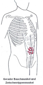 Bauchbereich ziehen rechten im unteren Ziehen im