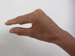 Muskeln des Handtellers - Behandlung durch Pohltherapie