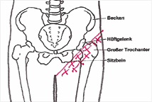 Leistenschmerzen Leistenbruch Meistens Nicht Die Ursache
