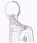 Rezeptoren im oberen Nackenbereich - Behandlung durch Pohltherapie