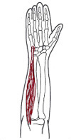 Handgelenksmuskel im Unterarm - Behandlung durch Pohltherapie